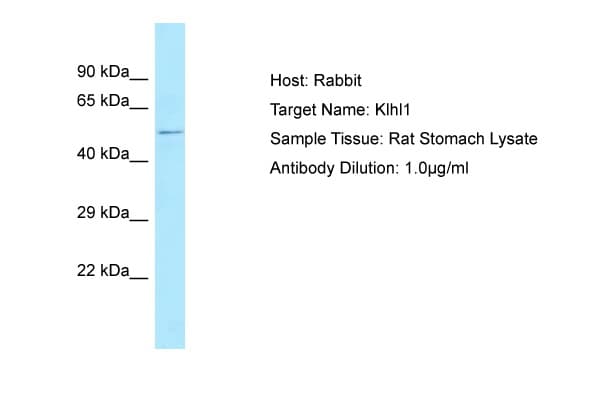 KLHL1 Antibody (aa72-121)