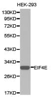 Polyclonal Rabbit anti-Human EIF4E Antibody (IHC, WB)