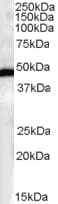 IHC-plus™ Polyclonal Goat anti-Human FBXL2 Antibody (aa2-14, IHC, WB)