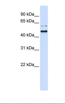 Polyclonal Rabbit anti-Human TUB / Tubby Antibody (N-Terminus, IHC, WB)
