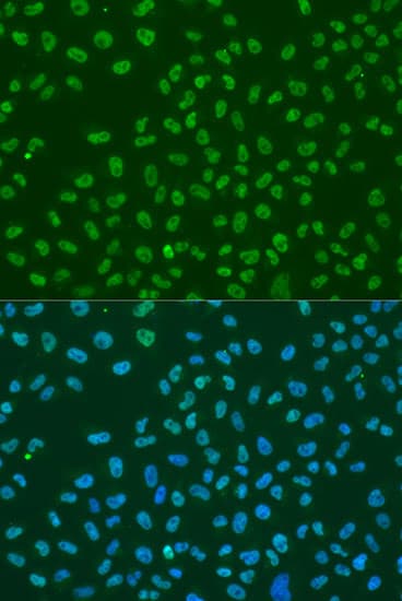 ELAVL1 / HUR Antibody
