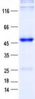 Human ZDHHC4 Protein (Recombinant His, N-Terminal)