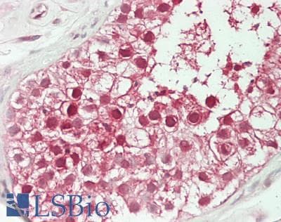 IHC-plus™ IPO7 / RANBP7 Antibody (aa200-250)