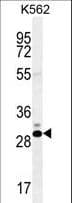 Polyclonal Rabbit anti-Human CT45A1 Antibody (aa1-30, WB)