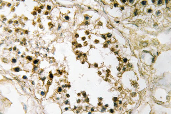 Polyclonal Rabbit anti-Human PAX2 Antibody (aa144-193, IHC, WB)