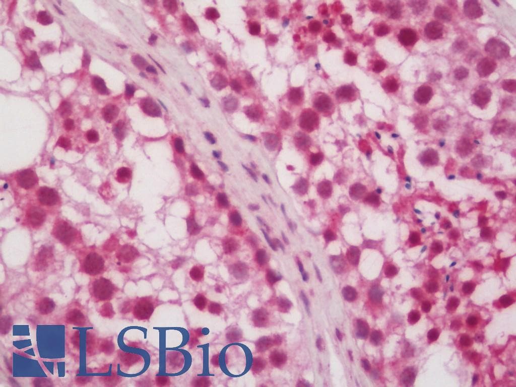 IHC-plus™ Polyclonal Rabbit anti-Human PRX-1 / PRRX1 Antibody (IHC, WB)