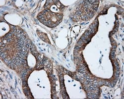PRKAR2A Antibody (clone OTI1B4)
