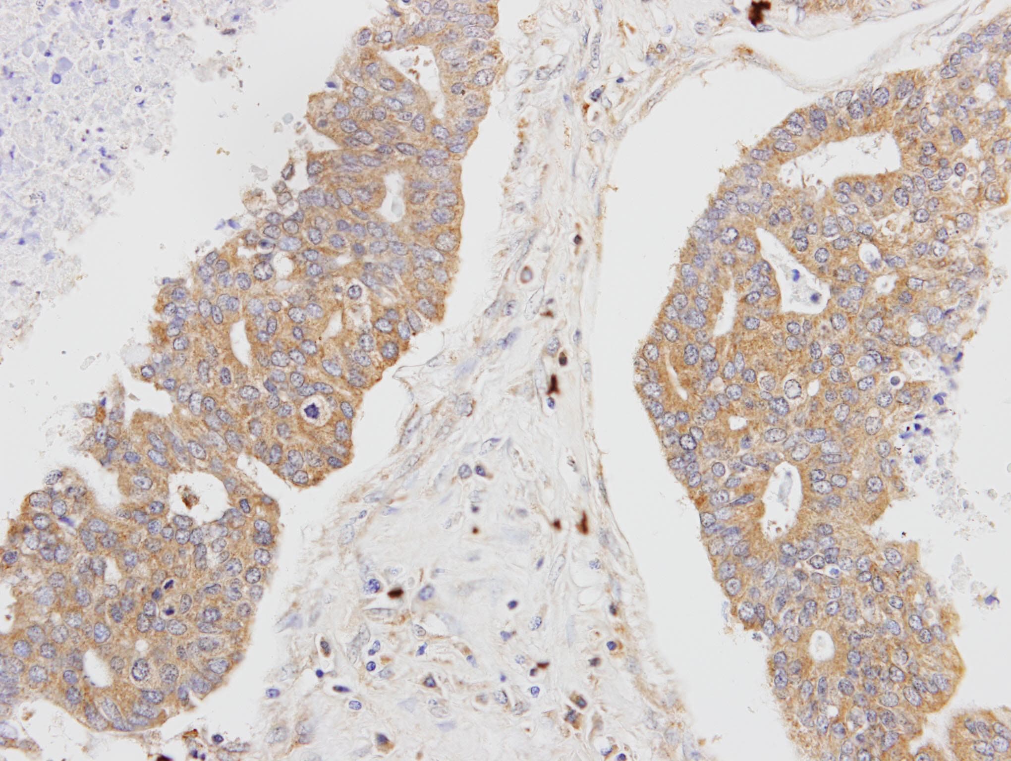 MSTO1 / MST Antibody (aa34-327)