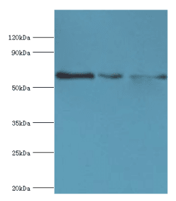 Polyclonal Rabbit anti-Human ABCE1 Antibody (aa320-599, IHC, WB)