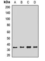 Polyclonal Rabbit anti-Human NTHL1 Antibody (WB)
