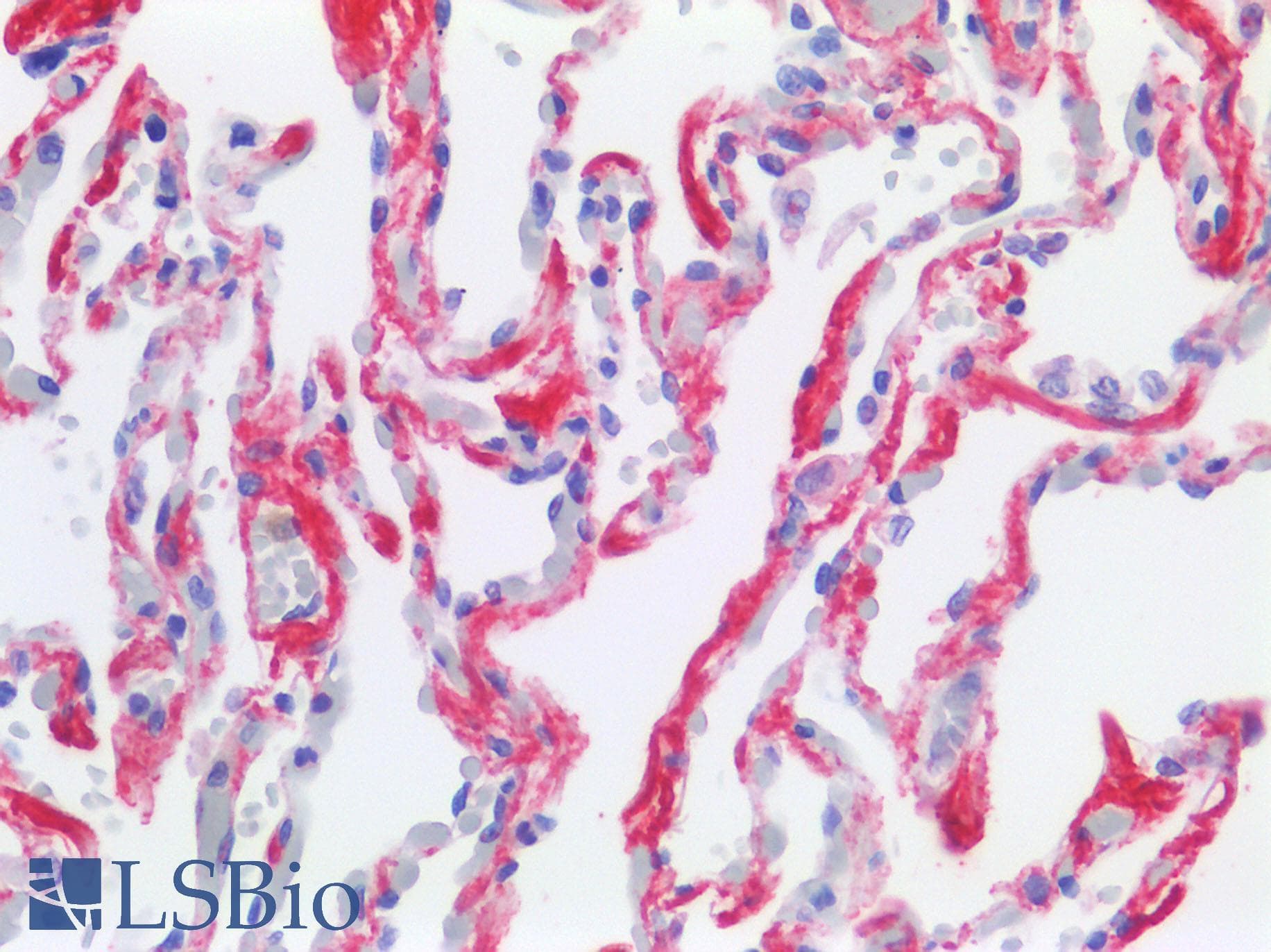 IHC-plus™ Monoclonal Mouse anti-Human TIMP3 Antibody (aa170-188, IHC, WB)