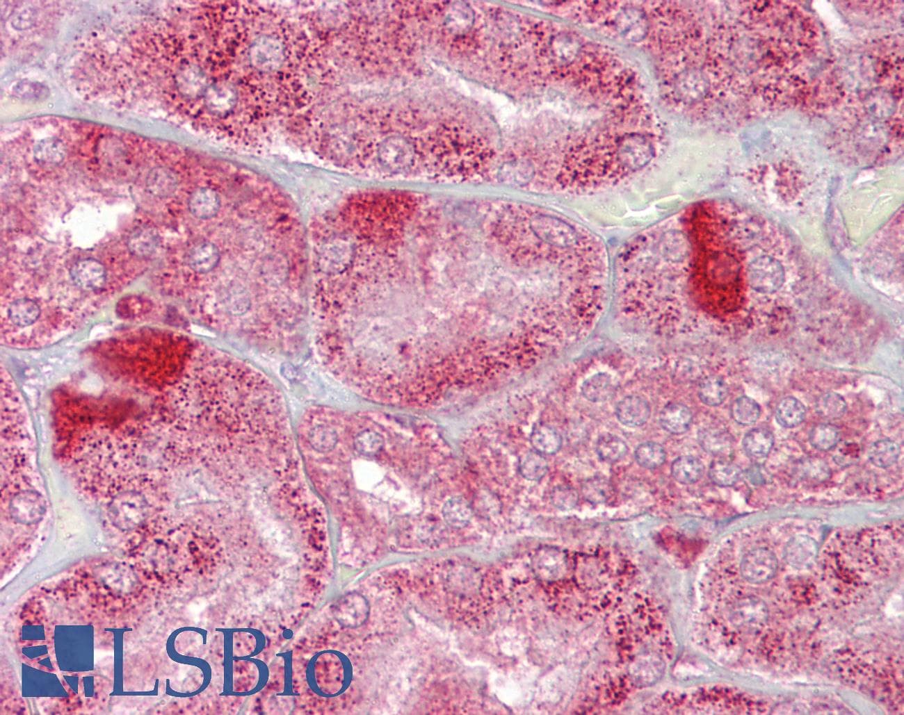 AMACR / P504S Antibody (aa286-335)