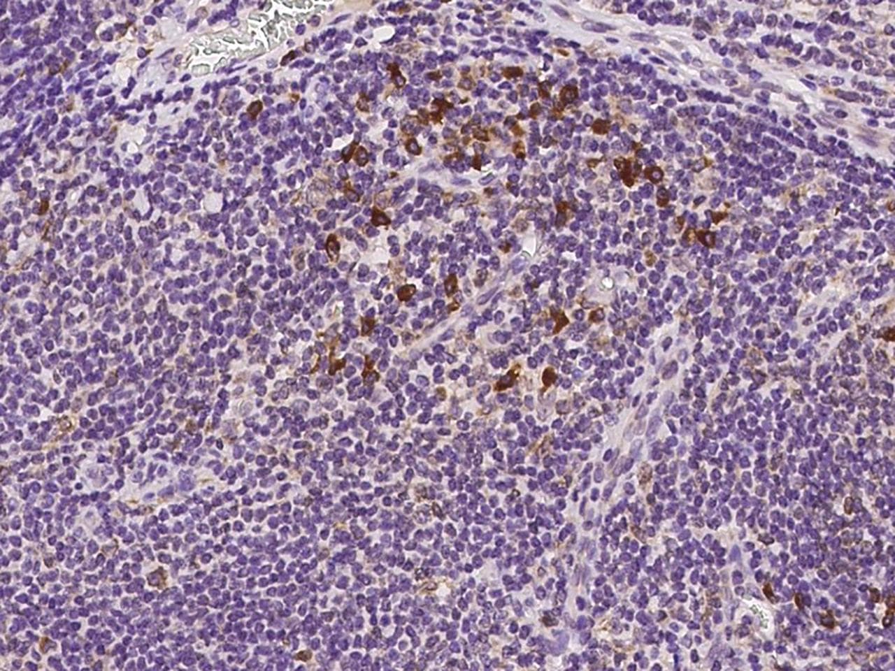 DERL2 / Derlin-2 Antibody