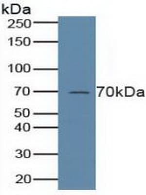 ALOX5 / 5-LOX Antibody (aa461-671)