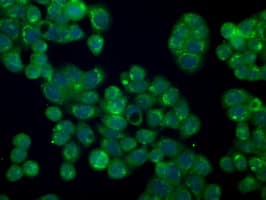 PMEL / SILV / gp100 Antibody (clone OTI7B2)