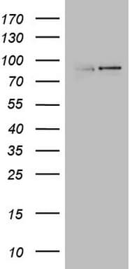 GPR49 / LGR5 Antibody (aa22-543, clone UMAB211)