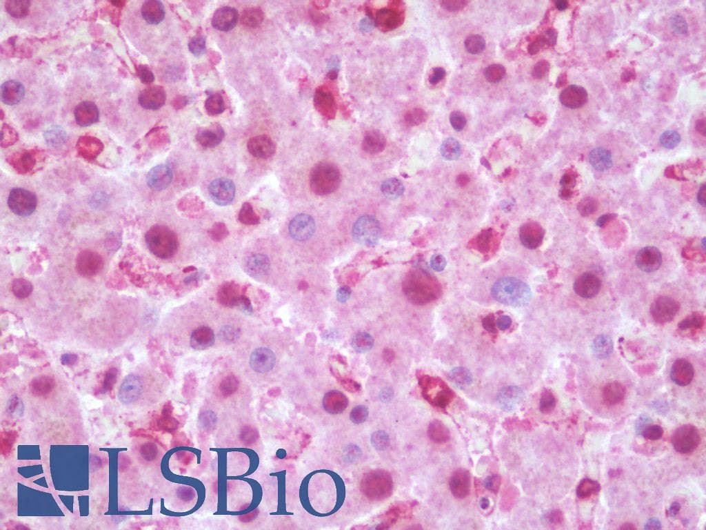 IHC-plus™ Polyclonal Rabbit anti-Human CNRIP1 Antibody (IHC, IF, WB)