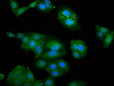 ZFR Antibody