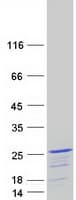 Human FOPNL Protein (Recombinant Myc-DDK (Flag))