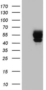 Monoclonal Mouse anti-Human POMK / SGK196 Antibody (clone OTI1B1, aa141-350, IHC, WB)