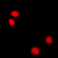 TIP48 / RUVBL2 Antibody