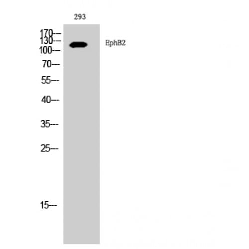 EPHB2 / EPH Receptor B2 Antibody (960-1040 aa, C-terminal)