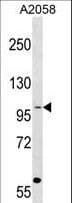 COPG / Gamma-COP Antibody (aa721-750)
