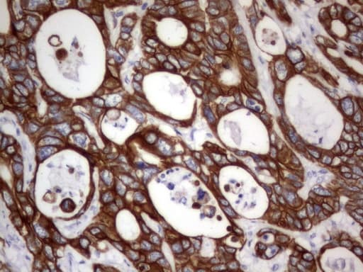 Acidic Cytokeratin Antibody (clone 8F5)