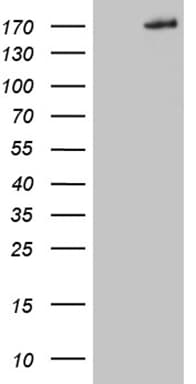 Monoclonal Mouse anti-Human COL5A2 / Collagen V Alpha 2 Antibody (clone OTI2H3, aa1200-1499, WB)