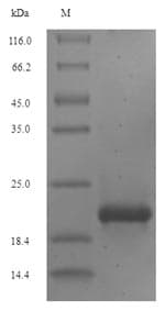 Human EREG / Epiregulin Protein (Recombinant 6His-SUMO, N-terminus)
