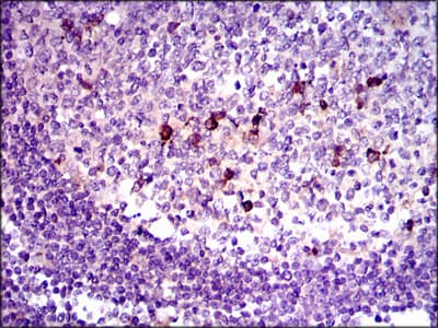 TGFB1 / TGF Beta 1 Antibody (clone 7F6)