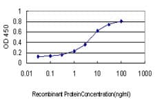 IHC-plus™ Monoclonal Mouse anti-Human RAB3B Antibody (clone 3F12, IHC, IF, WB)