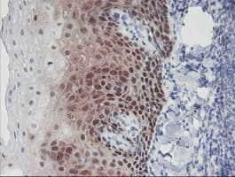 IRF6 Antibody (clone OTI2C10, Carrier-free)