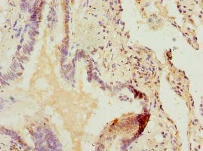 ZDHHC5 Antibody