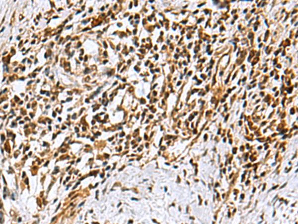 KDM2B / FBXL10 Antibody