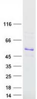 Human SOX18 Protein (Recombinant Myc-DDK (Flag))