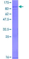 Human VANGL2 / LTAP Protein (Recombinant GST)