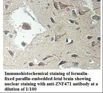 Polyclonal Rabbit anti-Human ZNF471 Antibody (aa24-221, IHC, WB)