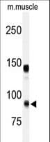IHC-plus™ ADAMTS5 Antibody (aa331-360)