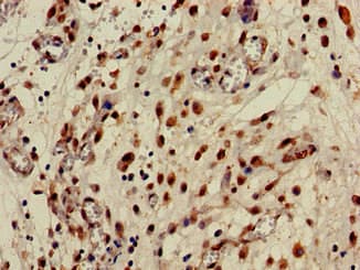 CPB2 / TAFI Antibody
