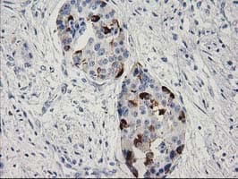 RGS5 Antibody (clone OTI1C1, Carrier-free)