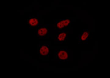 ELK1 Antibody