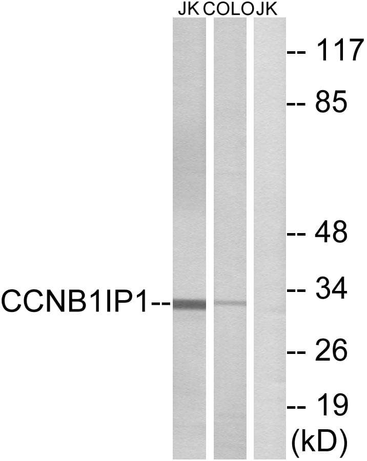 Polyclonal Rabbit anti-Human CCNB1IP1 Antibody (WB)