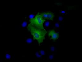 PSMC3 Antibody (clone OTI8D6)