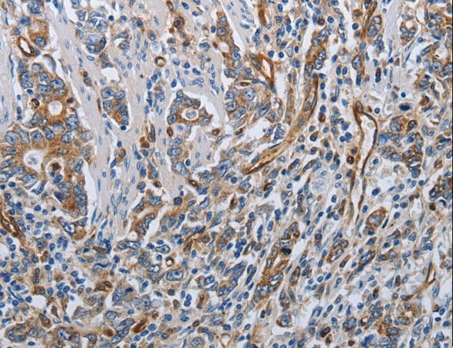 SOCS1 Antibody