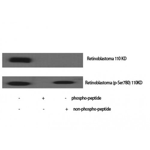 RB1 / Retinoblastoma / RB Antibody (720-800 aa)