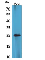 CKLFSF5 / CMTM5 Antibody