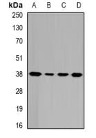 GALE / UDP-Glucose 4-Epimerase Antibody