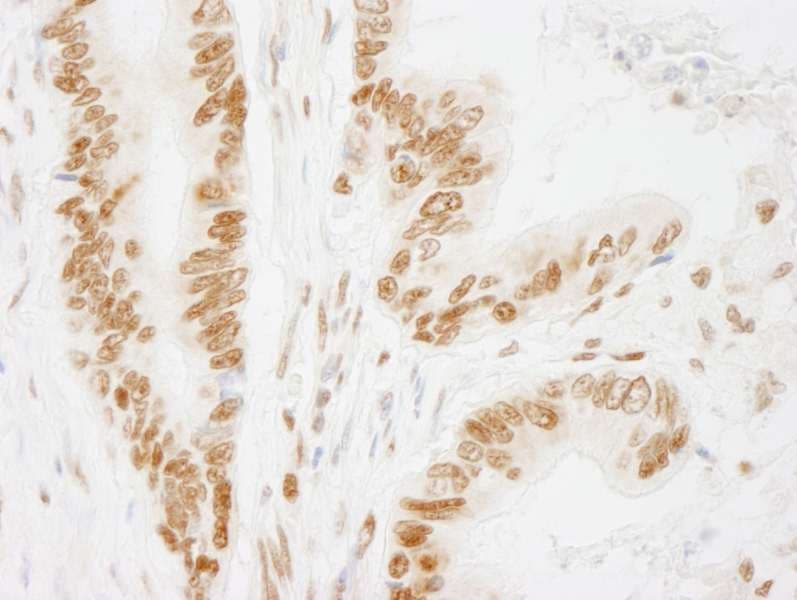 ACIN1 / Acinus Antibody (aa1291-C-term)