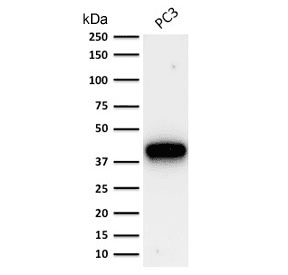 AMACR / P504S Antibody (clone AMACR/1864, Ready-to-Use)